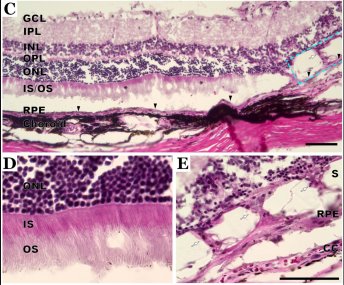 Local tolerability of DTVRF-hiPSC-ARG