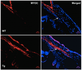 Transgene (Y437H MYOC) and WT MYOC expression were examined in 6-month-old WT and Tg-MYOC-Y437H littermates.  Immunostaining revealed that MYOC was localized to TM and is increased in Tg-MYOC-Y437H mice (bottom panels) compared with WT littermates (top panels). The trabecular meshwork is shown by the arrow.