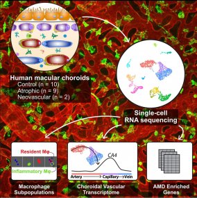 Single-cell transcriptomics in normal and AMD choroid Single-cell transcriptomics in normal and AMD choroid