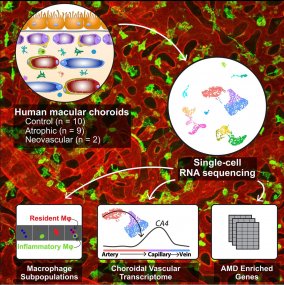 Single-cell transcriptomics in normal and AMD choroid