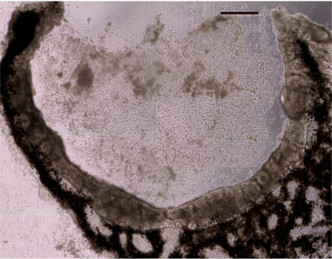 Differentiation of human USH2A-associated iPSCs into eyecup-like structures