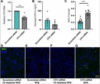 Knockdown of CFH increases membrane attack complex deposition